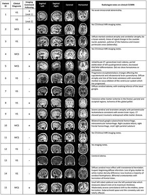 Do Patients Thought to Lack Consciousness Retain the Capacity for Internal as Well as External Awareness?